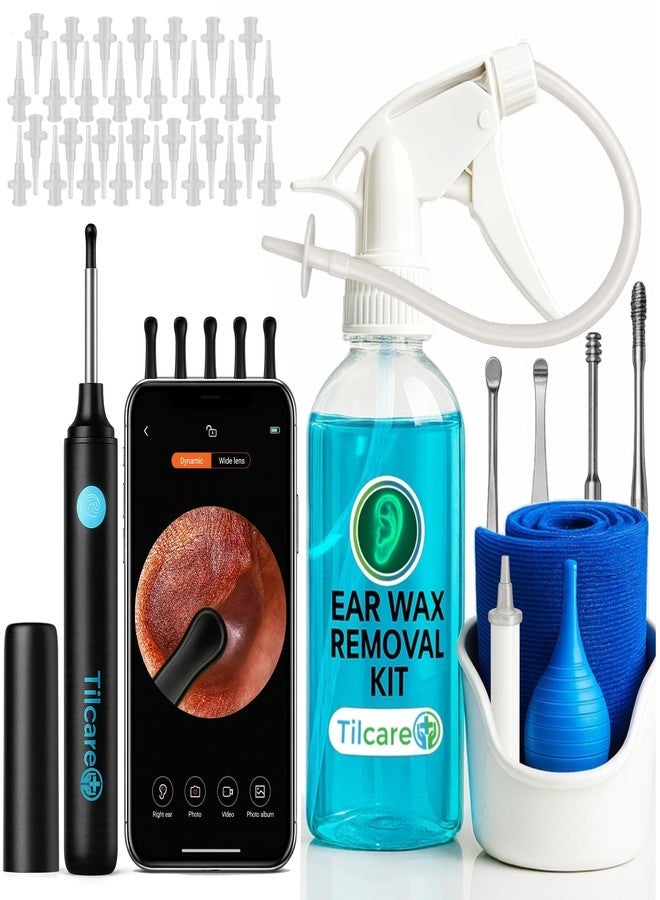 Tilcare Ear Wax Removal Tool with Ear Camera by Tilcare - Ear Irrigation Flushing System for Adults & Kids - Perfect Ear Cleaning Kit - includes Basin, Syringe, Curette Kit, Towel and 30 Disposable Tips - Image 1